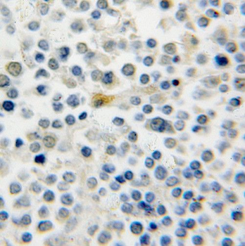 RAB39B antibody