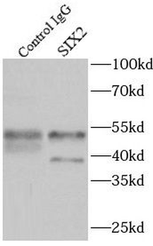 SIX2 antibody