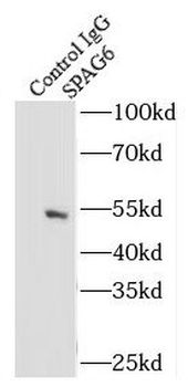 SPAG6 antibody