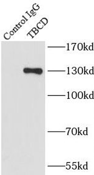 TBCD antibody