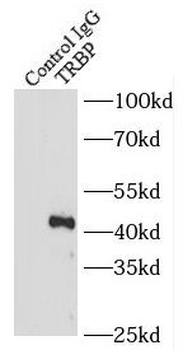 TRBP antibody