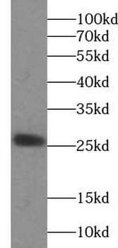 Cardiac Troponin IÃ‚Â antibody