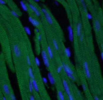 Cardiac Troponin IÃ‚Â antibody