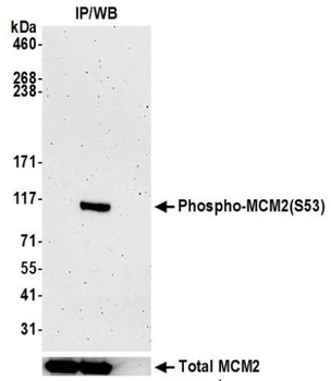 MCM2, Phospho (S53) Antibody