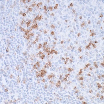 PD-1 Antibody