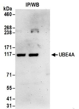UBE4A Antibody