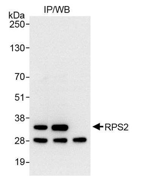 RPS2 Antibody