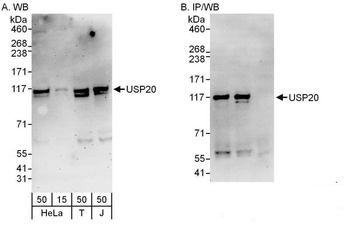 USP20/VDU2 Antibody