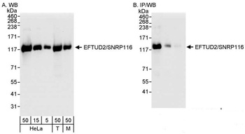 EFTUD2/SNRP116 Antibody