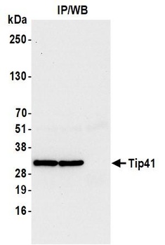 Tip41 Antibody
