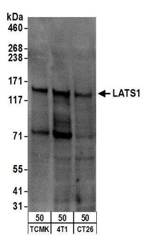 LATS1 Antibody