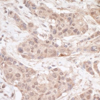 FHL2 Antibody