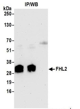 FHL2 Antibody