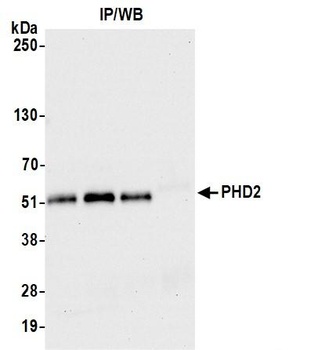 PHD2 Antibody