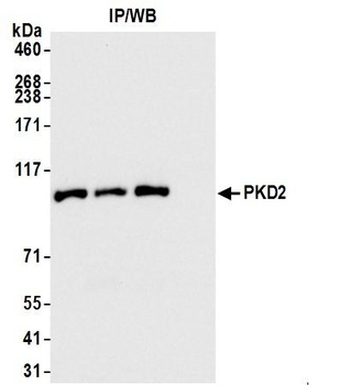 PKD2 Antibody