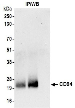 CD94 Antibody