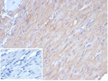 Caldesmon antibody