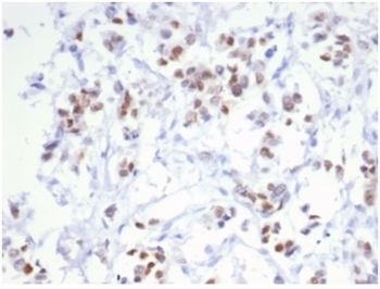 Estrogen Receptor alpha antibody