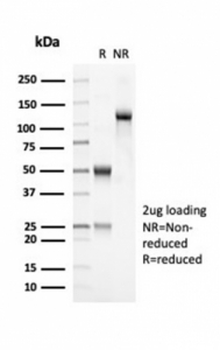 OLIG2 antibody