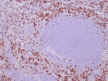 TIA-1 antibody