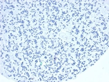 TIA-1 antibody