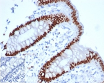 CDX2 antibody