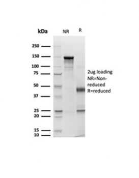 Pan Cytokeratin Cocktail antibody