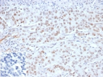 MLH1 antibody