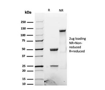 Luteinizing Hormone beta antibody