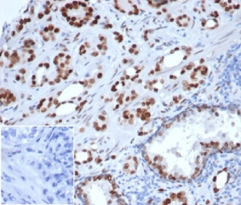 Androgen Receptor antibody