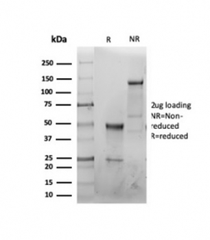 CFTR antibody