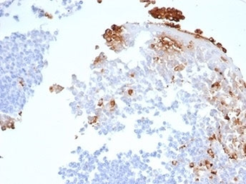 MPO antibody