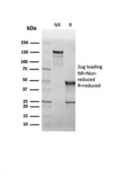 CFTR antibody