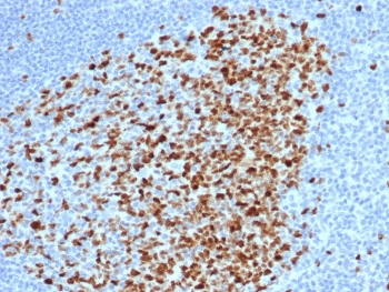 Topoisomerase II alpha antibody