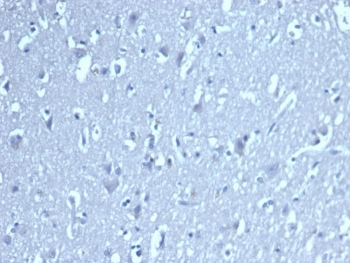 LEF1 antibody