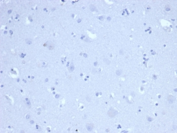 Ki-67 antibody