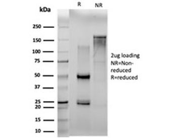 NMI antibody