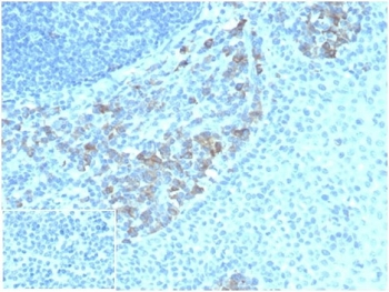 CD5L antibody