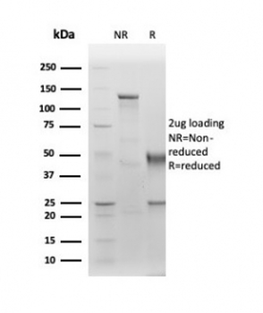 Albumin antibody