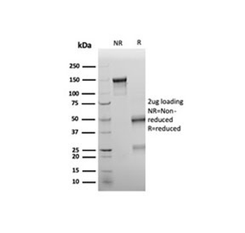 WT1 antibody