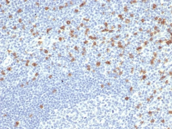CD8A antibody