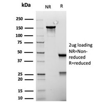 MSH6 antibody