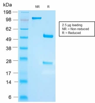 FSH beta antibody