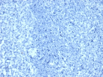 HER2 antibody