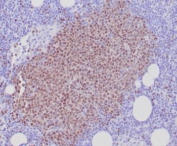 SOX11 antibody