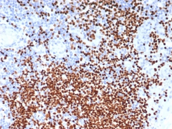 SOX11 antibody