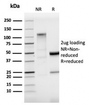 StAR antibody