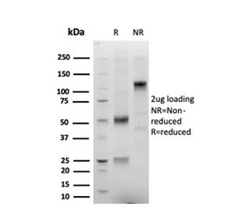 ERG antibody