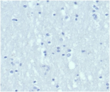 Keratin 6A antibody