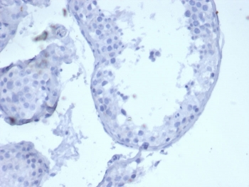 Cytokeratin 5 antibody